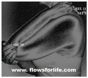 Shooting, Sharp Stabbing Pains in the Hea Neck and Face